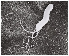 写真：ヘリコバクター・ピロリ菌（顕微鏡写真）