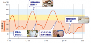 皮下連続式グルコース測定①