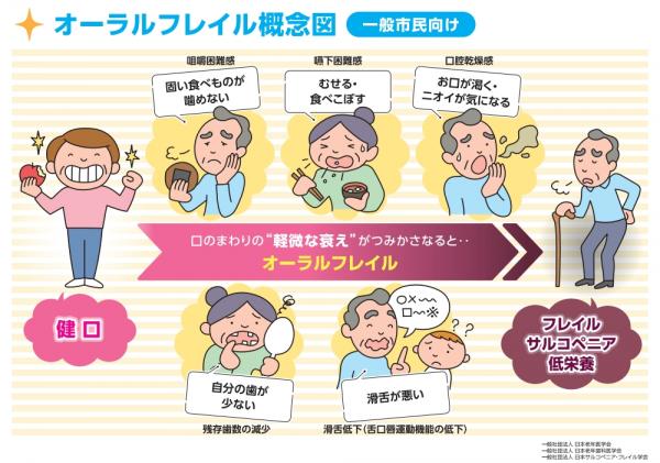 オーラルフレイル概念図